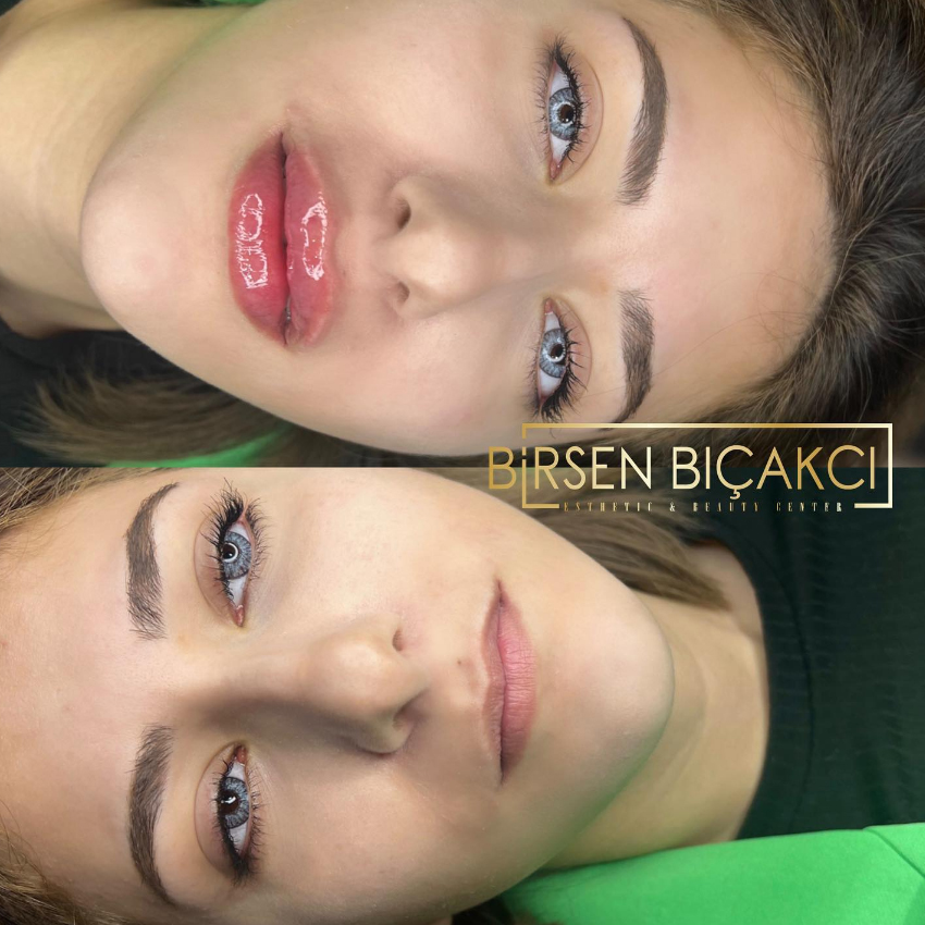 Birsen Bıçakçı