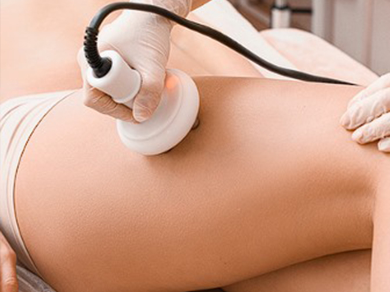 Heykeltraş  Zayıflama