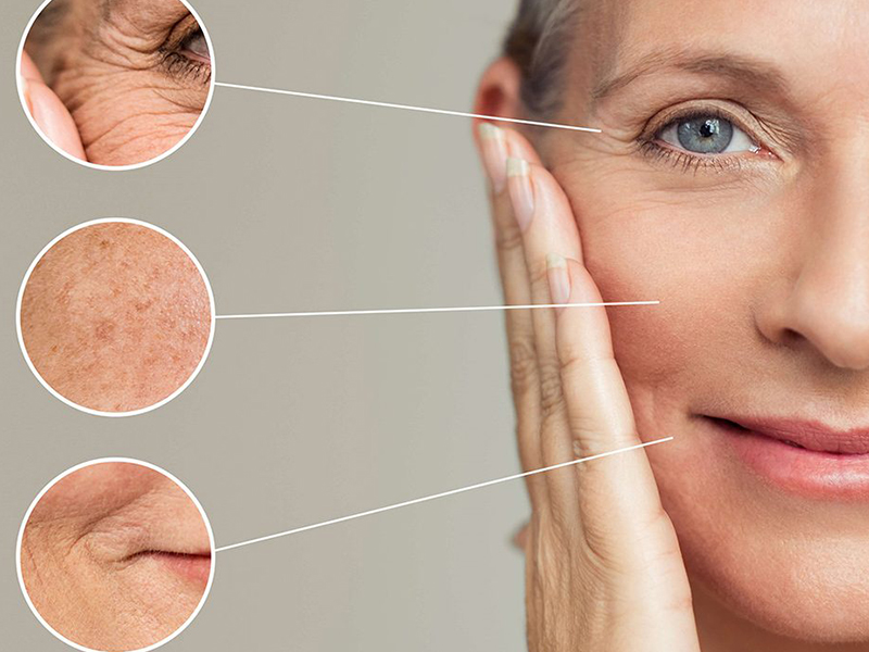 Kırışıklık Bakımı